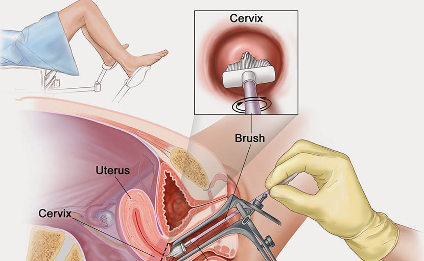 চল্লিশোর্ধ মহিলার ১০টি স্বাস্থ্য পরীক্ষা কোনগুলো জানেন?